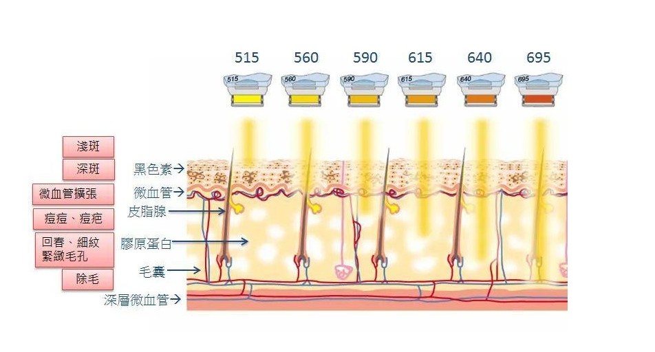 光子嫩膚各濾光片的效果