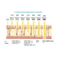 五大光子嫩膚技術（IPL、DPL、OPT、APT、BBL）及濾光片區(qū)別